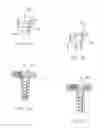 Fig. 16 - Single-lock plating system
