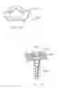 Fig. 28 - Single-lock plating system