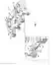 Fig. 04 - Spinal plate system for stabilizing a portion of a spine