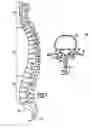 Fig. 02 - Spinal implant apparatuses and methods of implanting and using same