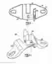 Fig. 04 - Spinal implant apparatuses and methods of implanting and using same