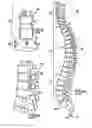 Fig. 08 - Spinal implant apparatuses and methods of implanting and using same