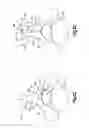 Fig. 03 - Methods and systems for minimally invasive posterior arch expansion