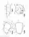 Fig. 09 - Methods and systems for minimally invasive posterior arch expansion