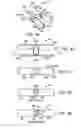 Fig. 05 - Interspinous spacer