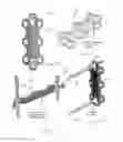 Fig. 03 - ADJUSTABLE CERVICAL PLATE