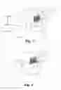 Fig. 03 - Method for distracting opposing vertebral bodies of a spine