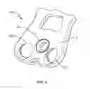 Fig. 04 - Retaining mechanism