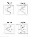 Fig. 13 - Methods and apparatus for insertion of vertebral body distraction and fusion devices