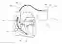 Fig. 01 - Implantable device for transmitting therapeutic and diagnostic signals