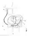 Fig. 02 - Implantable device for transmitting therapeutic and diagnostic signals