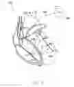 Fig. 06 - Systems and methods for assessing the sphericity and dimensional extent of heart chambers for use with an implantable medical device
