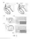 Fig. 10 - Systems and methods for assessing the sphericity and dimensional extent of heart chambers for use with an implantable medical device