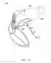 Fig. 12 - Systems and methods for assessing the sphericity and dimensional extent of heart chambers for use with an implantable medical device