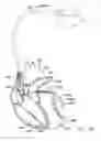 Fig. 15 - Systems and methods for assessing the sphericity and dimensional extent of heart chambers for use with an implantable medical device