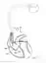 Fig. 18 - Systems and methods for assessing the sphericity and dimensional extent of heart chambers for use with an implantable medical device