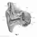 Fig. 02 - Cochlear Implant with Cochleostomy Ground