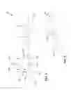 Fig. 03 - Implantable device