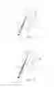 Fig. 03 - LOW LEVEL LASER THERAPY FOR LOW BACK PAIN