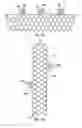 Fig. 02 - Apparatus and method for deploying an implantable device within the body