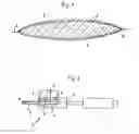 Fig. 02 - Intraocular Lens
