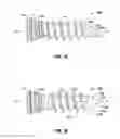 Fig. 08 - Spinal interbody spacer
