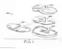 Fig. 02 - Provisional tibial prosthesis system
