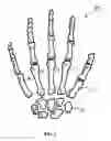 Fig. 02 - TRAPEZIUM PROSTHESIS