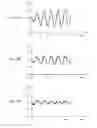 Fig. 05 - Power delivery noise reduction on a memory channel