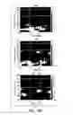 Fig. 24 - COMPOSITIONS AND METHODS FOR EVALUATING COGNITIVE DEFECTS