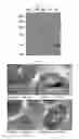 Fig. 04 - Extracellular vesicles derived from gram-positive bacteria, and use thereof