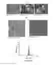 Fig. 05 - Extracellular vesicles derived from gram-positive bacteria, and use thereof