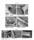 Fig. 06 - Extracellular vesicles derived from gram-positive bacteria, and use thereof