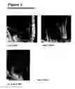 Fig. 05 - Methods for modulating cell proliferation in the seed coat and/or integument