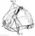 Fig. 01 - Method and device for providing an opening on a head strap on a Baseball or Softball sports protective face mask to permit a person to tie back their hair or wear a ponytail style while properly securing the head strap