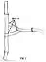 Fig. 02 - Method and device for providing an opening on a head strap on a Baseball or Softball sports protective face mask to permit a person to tie back their hair or wear a ponytail style while properly securing the head strap