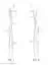 Fig. 02 - Oral care implement with customizable element