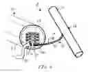 Fig. 06 - Method and apparatus for installing a racquet safety cord