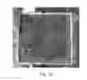 Fig. 11 - Use of bimodal carbon distribution in compacts for producing metallic iron nodules