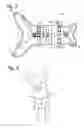 Fig. 04 - Animal Harness