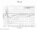 Fig. 08 - Internal combustion engine with masking wall the curtain area of the intake valves