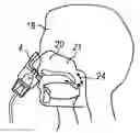 Fig. 01 - Portable nebulizer device