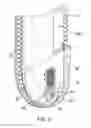 Fig. 04 - Window treatment with cord guard