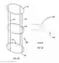 Fig. 03 - Cylindrical cartridge filter with detachable core