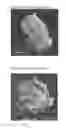 Fig. 07 - Permeable porous composite