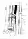 Fig. 04 - CUTTING APPARATUS