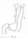 Fig. 32 - Method of Using A Surgical Stapler To Secure A Tissue Fold