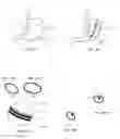 Fig. 02 - Methods and devices for reducing gastric volume