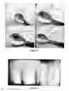 Fig. 29 - METHOD FOR THE PRODUCTION OF COMMERCIAL NANOPARTICLE AND MICRO PARTICLE POWDERS