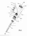 Fig. 02 - Catheter insertion sterilization